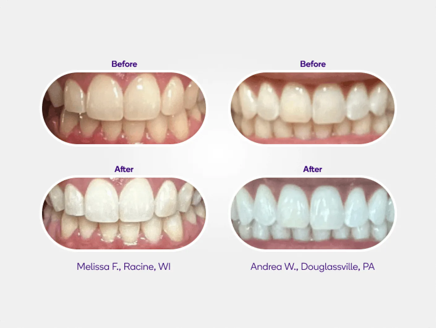 Non-Slip Whitening Strips Refill